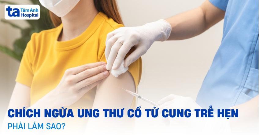 Chích ngừa ung thư cổ tử cung trễ hẹn có sao không? Phải làm sao?