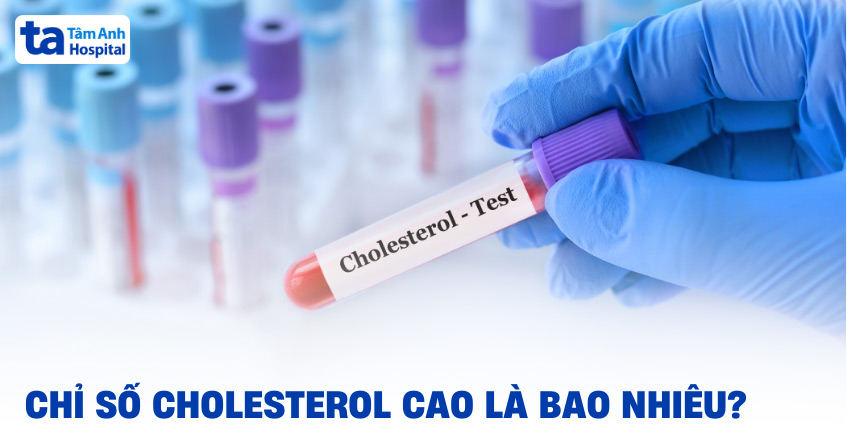 Cholesterol cao là bao nhiêu? Cách xét nghiệm và theo dõi chỉ số