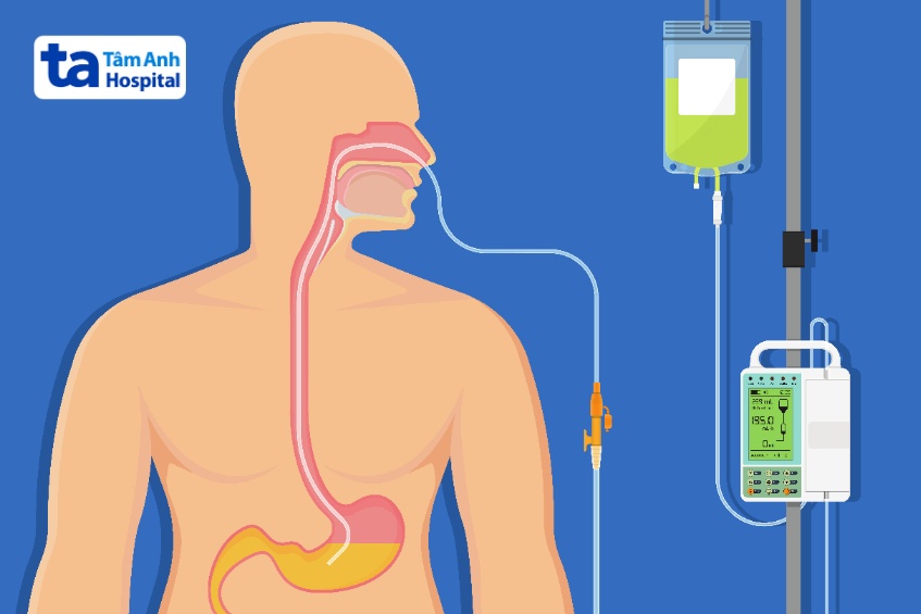 chữa rò khí quản thực quản
