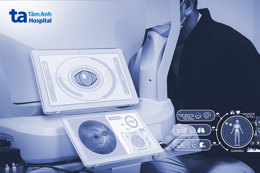 chụp oct chẩn đoán thoái hóa dịch kính