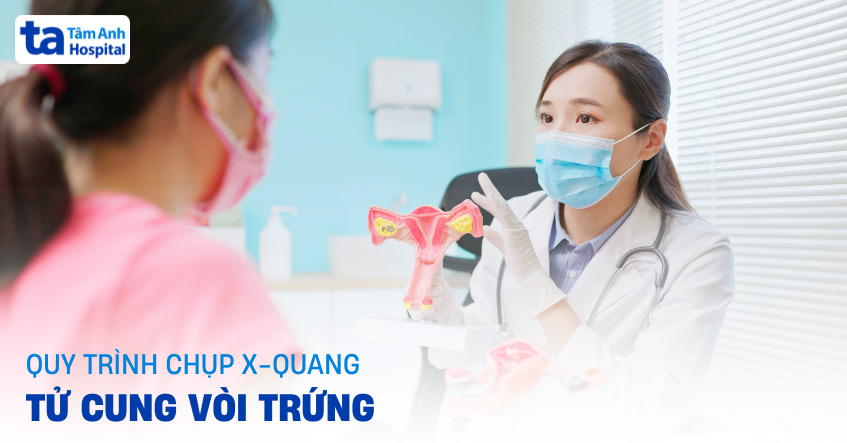 Chụp X-quang tử cung vòi trứng (HSG) là gì? Ưu điểm và quy trình