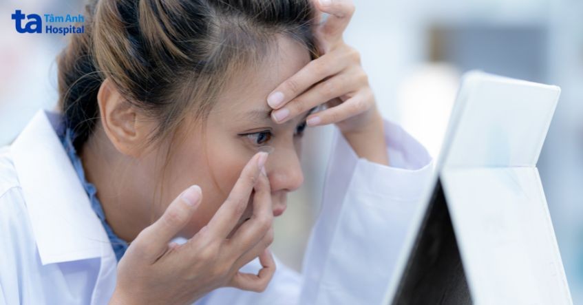 có nên đeo kính áp tròng khi cận 5 độ