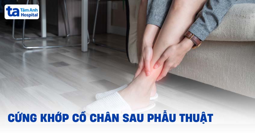 Cứng khớp cổ chân sau phẫu thuật