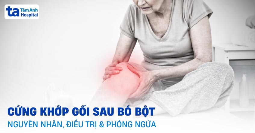 Cứng khớp gối sau bó bột: Nguyên nhân, điều trị và phòng ngừa