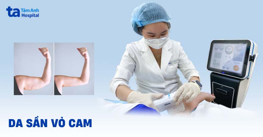 Da sần sùi vỏ cam