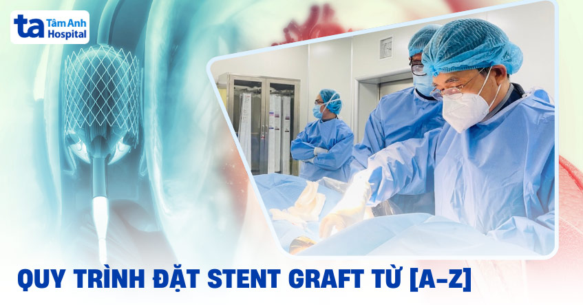 Thủ thuật đặt stent graft