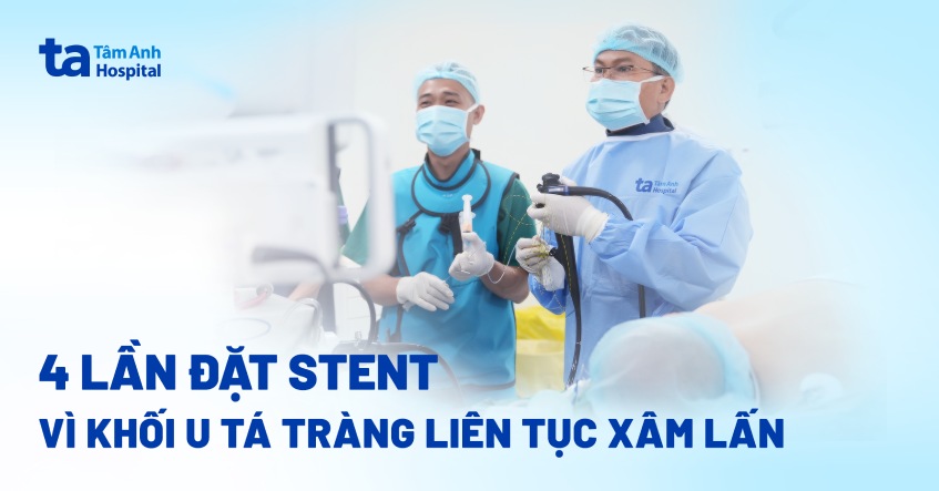 4 lần đặt stent vì khối u tá tràng liên tục xâm lấn