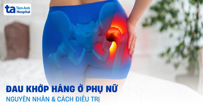Đau khớp háng ở phụ nữ: Nguyên nhân, triệu chứng và cách điều trị