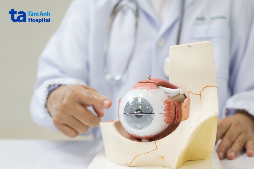 dịch kính duy trì hình dạng mắt