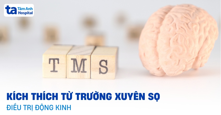 Tìm hiểu điều trị động kinh bằng kích thích từ trường xuyên sọ