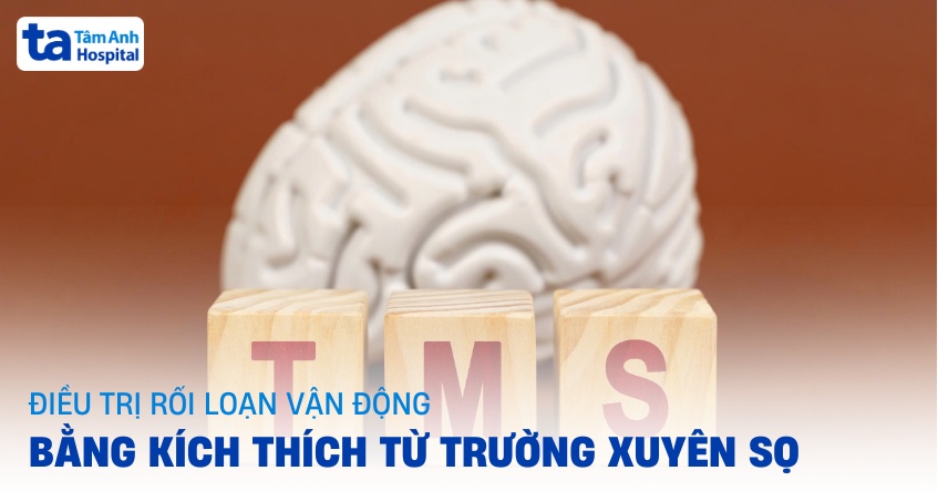 Điều trị rối loạn vận động bằng kích thích từ trường xuyên sọ