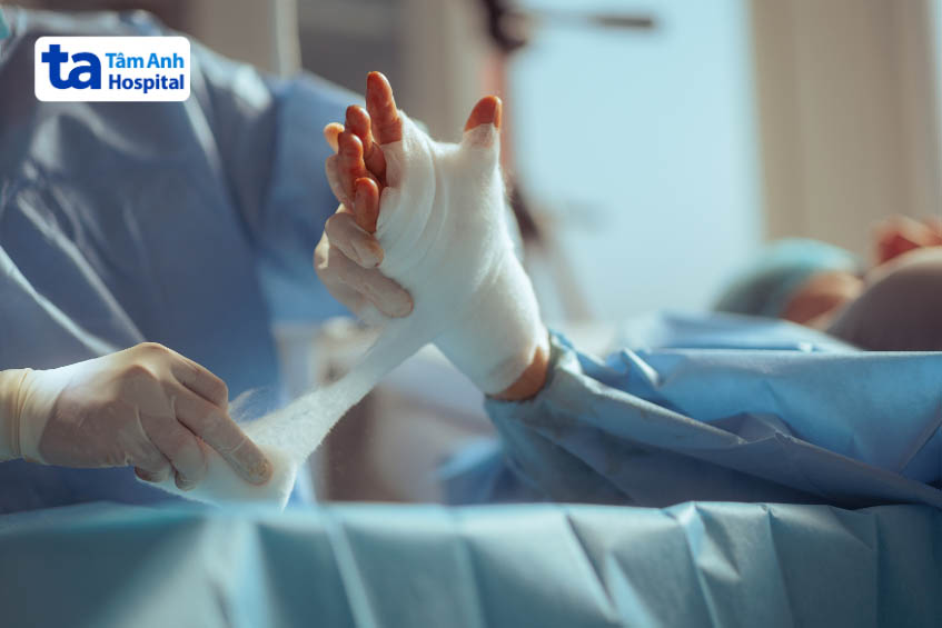 điều trị tràn dịch khớp ngón tay