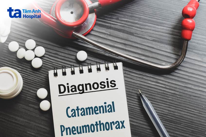 Điều trị tràn khí màng phổi bằng thuốc được chỉ định