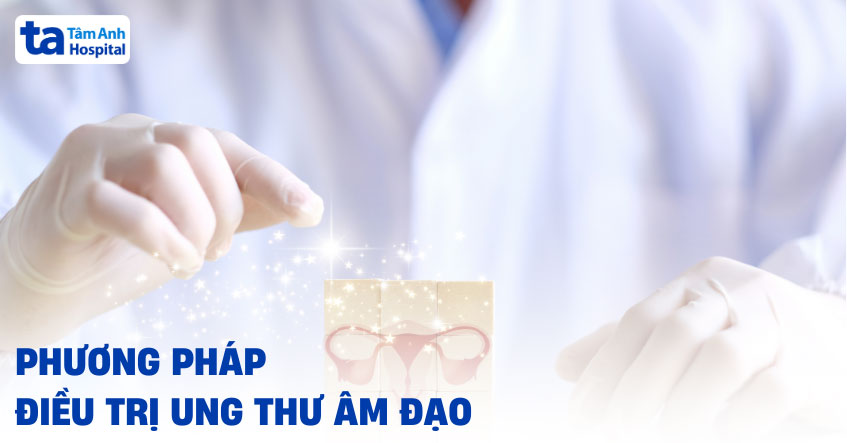 Điều trị ung thư âm đạo như thế nào? Bệnh có chữa được không?