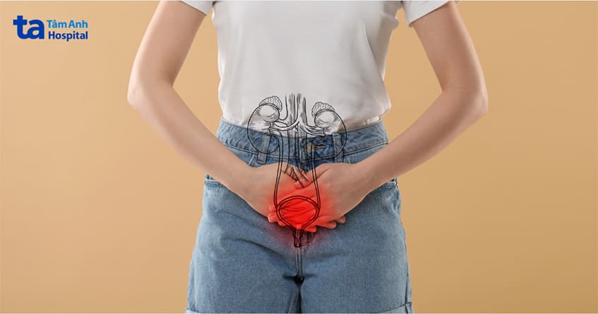 Điều trị viêm bàng quang bằng thuốc khi bị nhiễm khuẩn nước tiểu