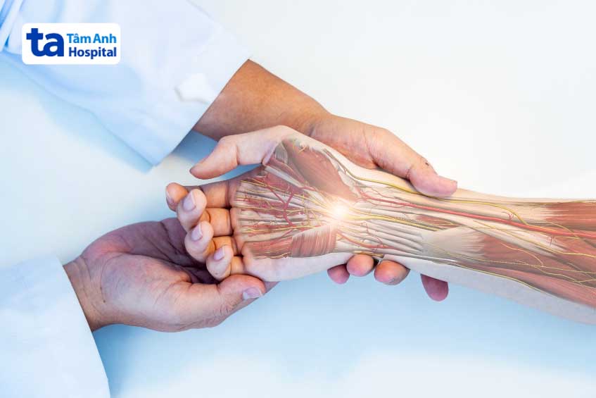 điều trị viêm bao gân de quervain