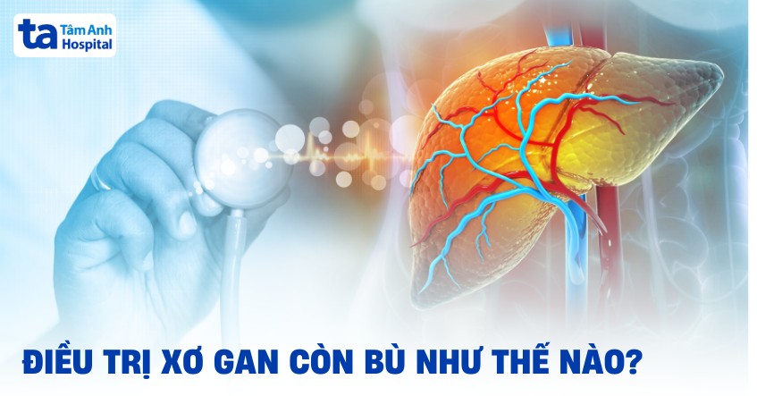 5 cách điều trị xơ gan còn bù mang lại hiệu quả nên tham khảo