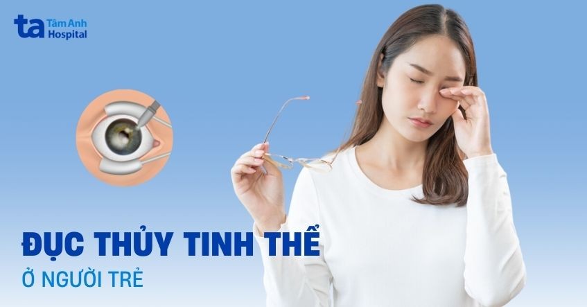 Đục thủy tinh thể ở người trẻ tuổi: Nguyên nhân và cách điều trị