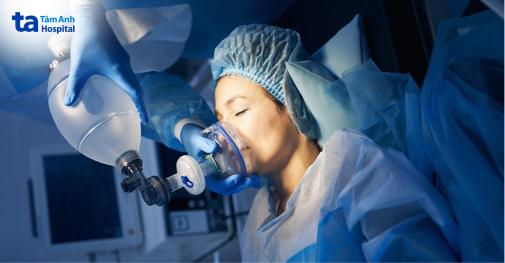 Gây mê nội khí quản là kỹ thuật gây mê toàn thân, để kiểm soát nhịp thở trong quá trình phẫu thuật