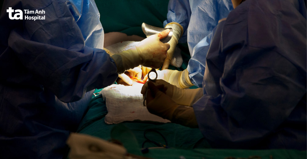 Gây tê cơ vuông thắt lưng được chỉ định trong phẫu thuật vùng bụng, mổ lấy thai, cắt tử cung toàn phần qua đường bụng,...