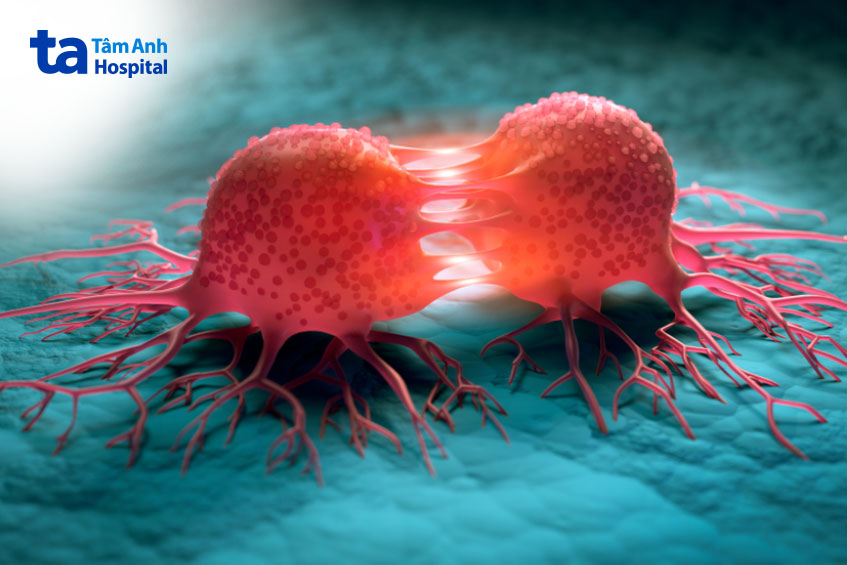 giai đoạn ung thư khoang miêng 3 và 4A