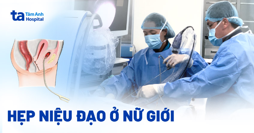 Hẹp niệu đạo ở nữ giới: Nguyên nhân, triệu chứng và cách điều trị