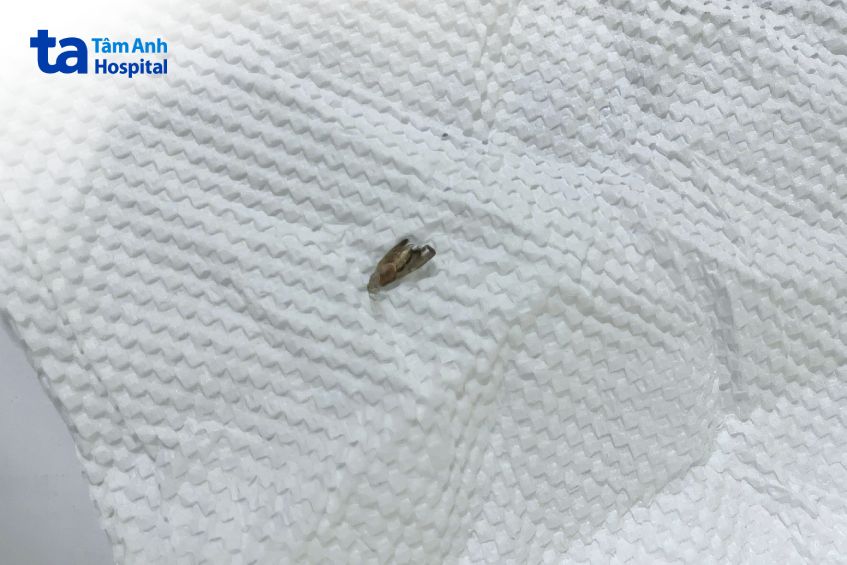 hình ảnh bướm lấy ra khỏi tai