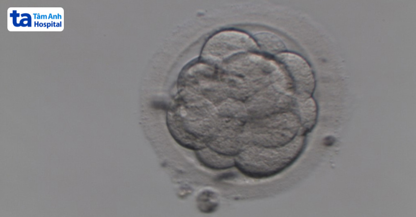 Hình ảnh phôi ngày 3 loại 2 được nuôi tại IVF Tâm Anh