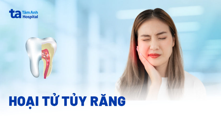 Hoại tử tủy răng là gì? Nguyên nhân, dấu hiệu tủy răng bị hư hại