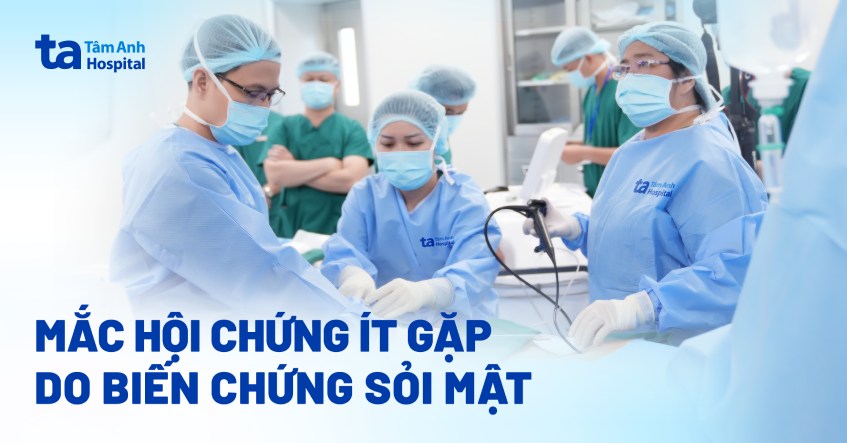 hội chứng ít gặp do biến chứng sỏi mật