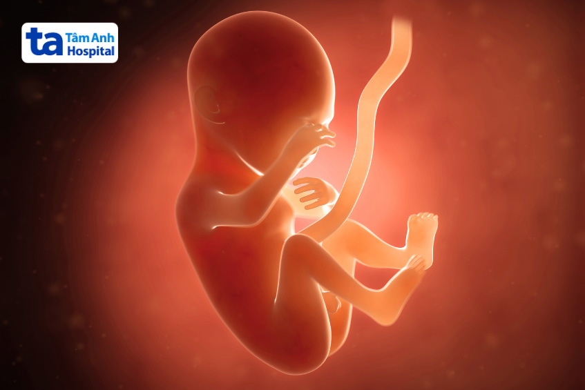 Hội chứng thiểu sản tim trái hình thành trong quá trình phát triển của thai kỳ