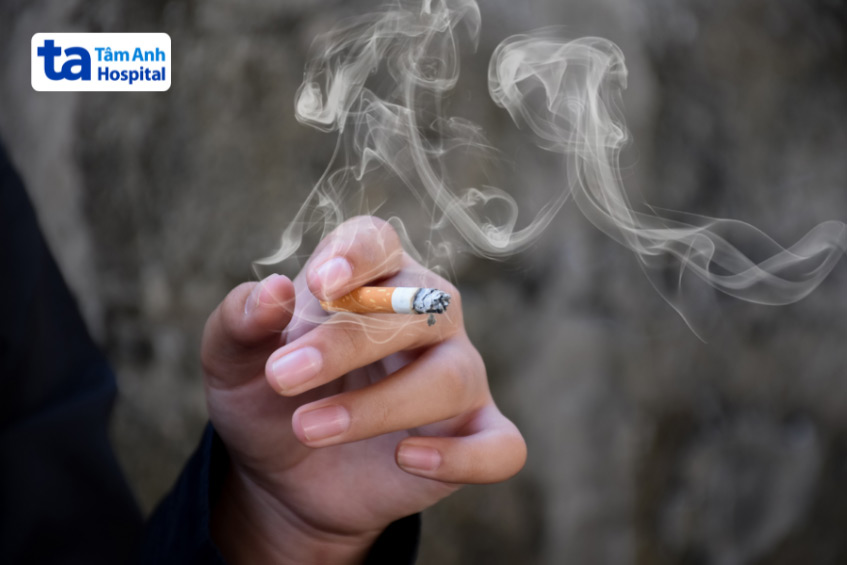 Hút thuốc lá là một trong những yếu tố nguy cơ hàng đầu gây huyết khối động mạch