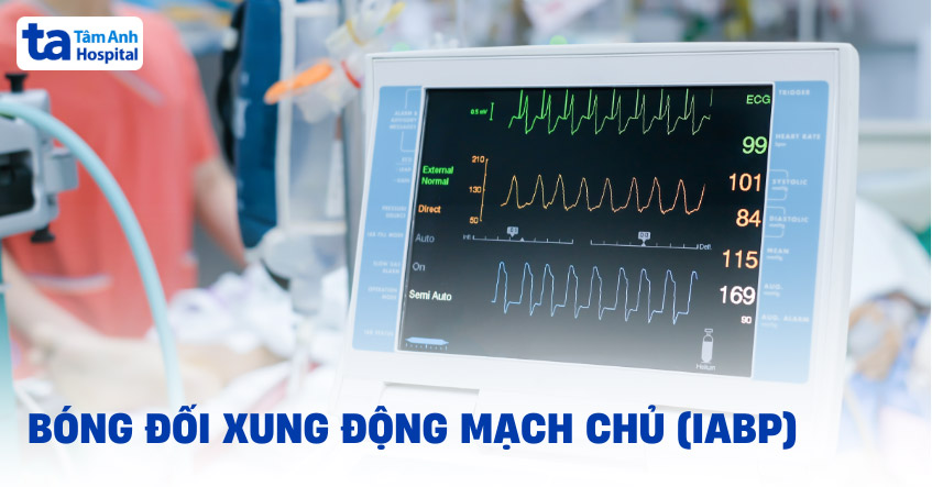 Kỹ thuật bóng đối xung động mạch chủ (IABP): Chỉ định, quy trình