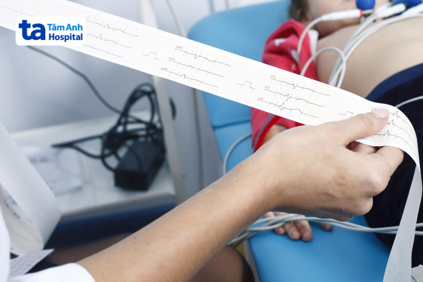 Kết quả từ phương pháp điện tâm đồ ECG có thể giúp bác sĩ chẩn đoán hội chứng Wolff-Parkinson-White