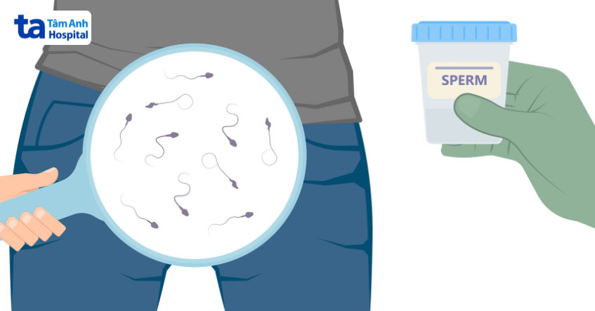 kiểm tra tinh trùng dị dạng