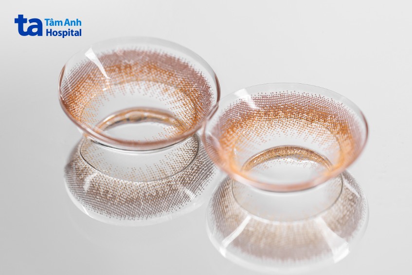 kính áp tròng điều trị tật khúc xạ