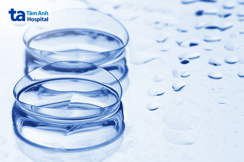 kính áp tròng phù hợp với người loạn thị