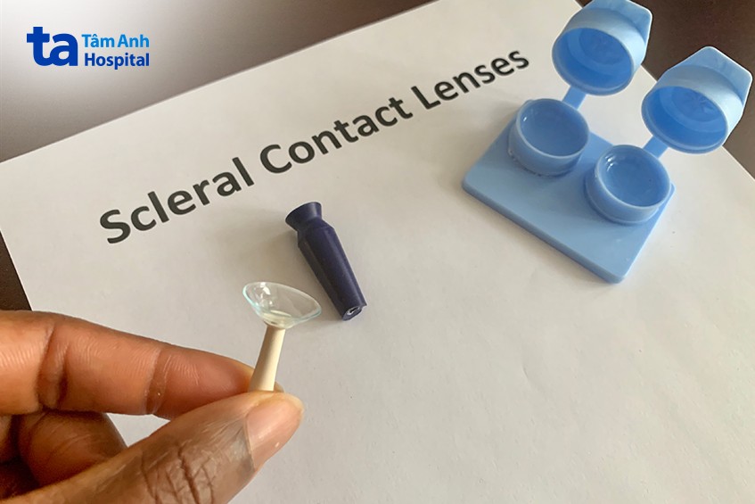 kính áp tròng scleral
