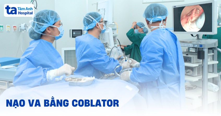 Phẫu thuật nội soi nạo va bằng coblator: Quy trình và chi phí