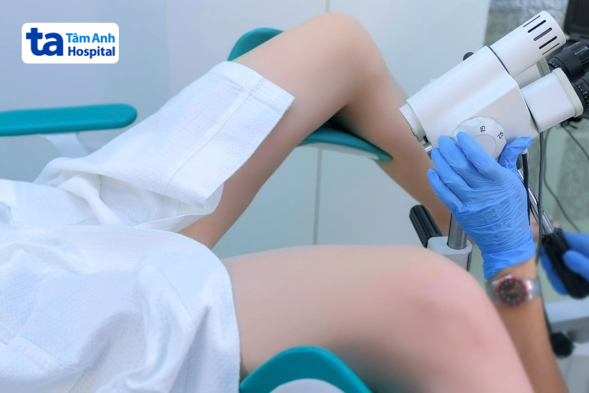 kỹ thuật soi cổ tử cung