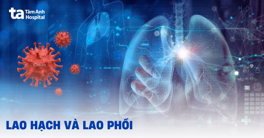 Lao hạch và lao phổi: Phân biệt, so sánh, chẩn đoán như thế nào?