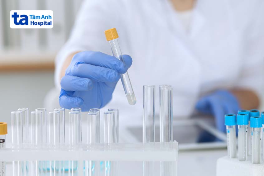 Lấy dịch khớp tìm nguyên nhân đau khớp