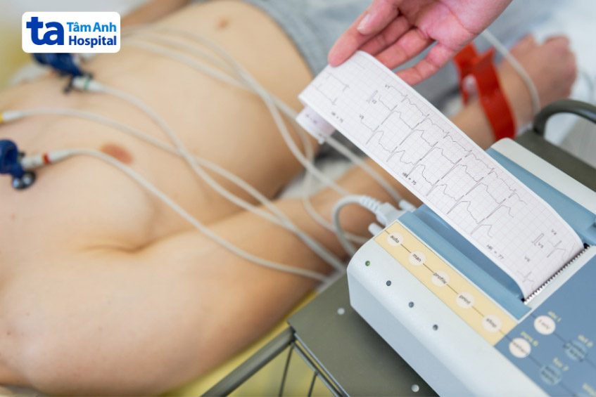 Loạn nhịp xoang thường được phát hiện qua đo điện tâm đồ