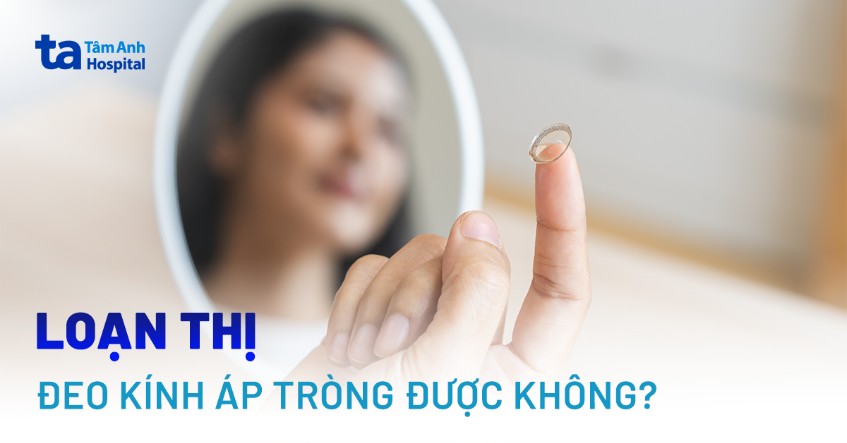 Mắt loạn thị có đeo kính áp tròng được không? Những lưu ý khi sử dụng