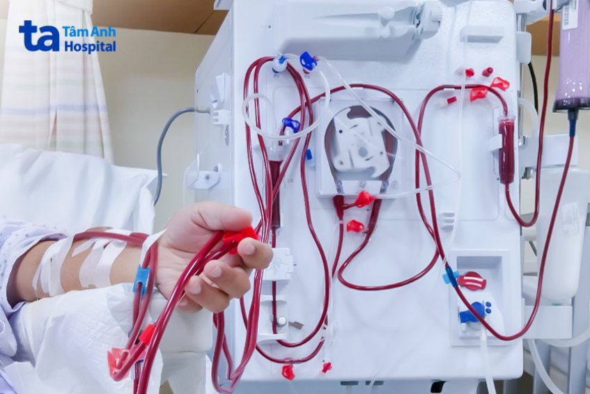 lọc máu ngắt quãng loại bỏ dịch dư thừa và chất thải ra khỏi cơ thể người bệnh