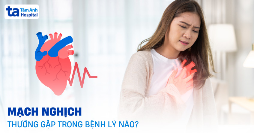 Mạch nghịch: Nguyên nhân, triệu chứng, chẩn đoán và điều trị