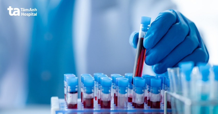 mẫu máu sẽ được gửi đến phòng thí nghiệm