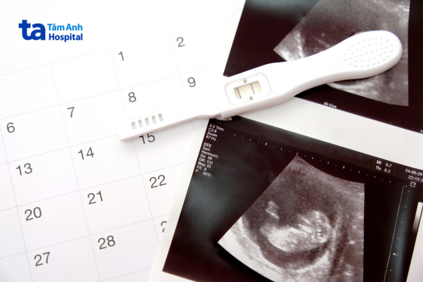Mẹ bầu cần lưu ý thời điểm siêu âm tim thai lý tưởng là tuần thứ 18 đến 24 của thai kỳ