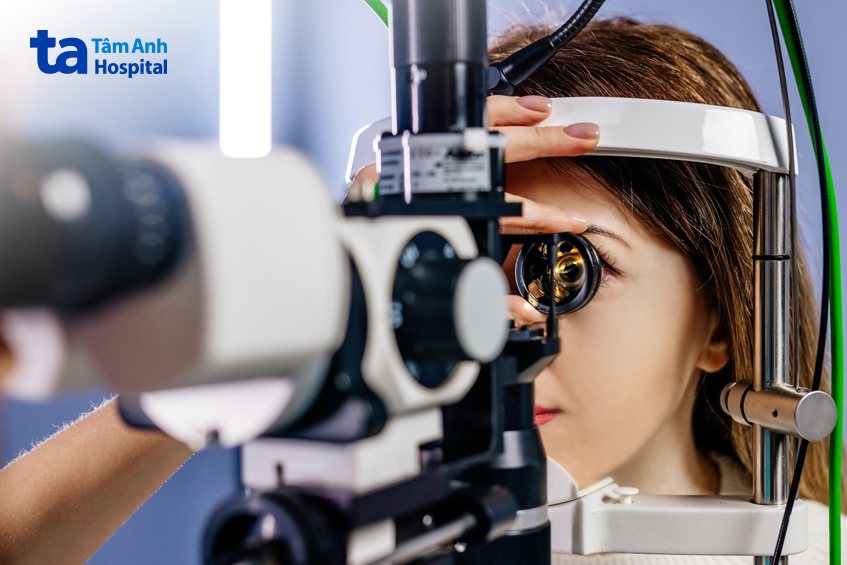 mổ loạn thị phụ thuộc vào các tiêu chí