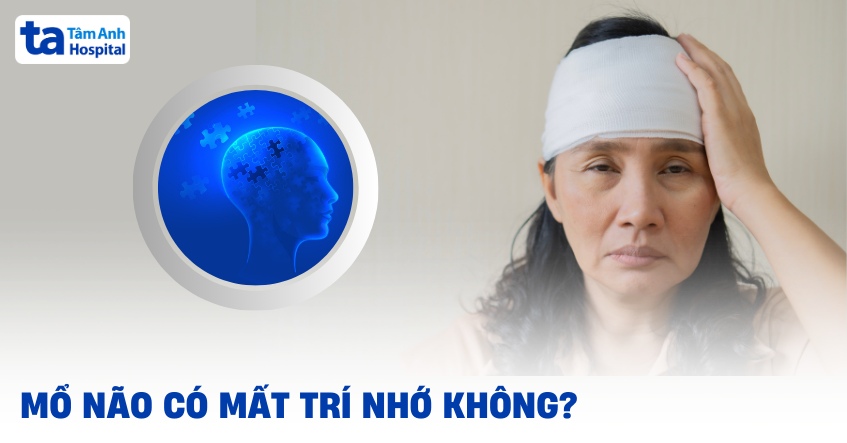 Mổ não có mất trí nhớ không? Tiên lượng ảnh hưởng trí nhớ ra sao?